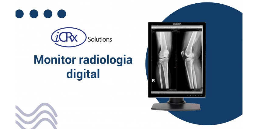 Monitor radiologia digital