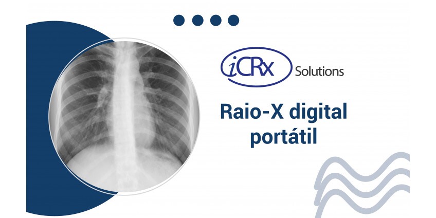 Raio X digital portátil Raio X digital portátil