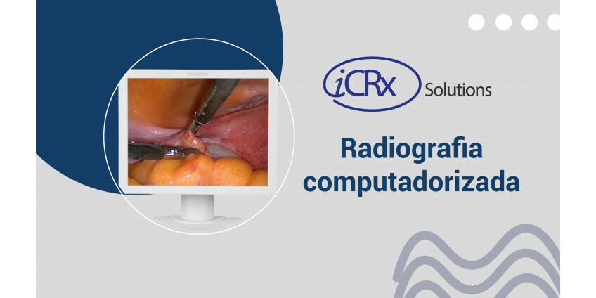 Radiografia computadorizada e digital: quais são as diferenças e os benefícios?