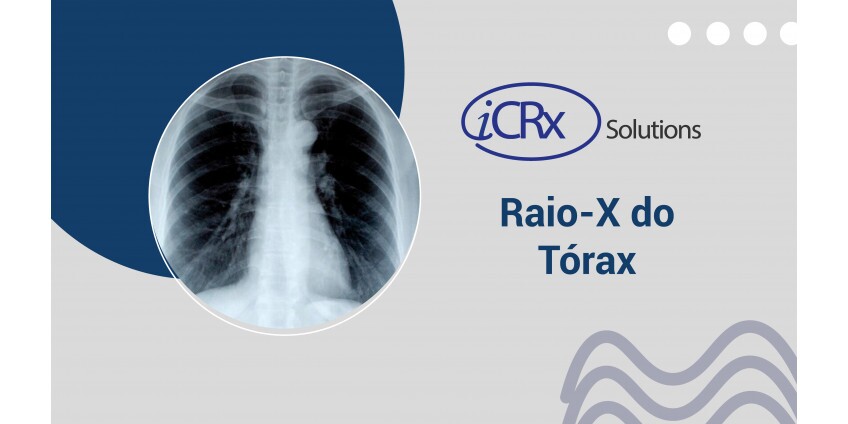 Raio X do tórax: o que analisar e para que serve?