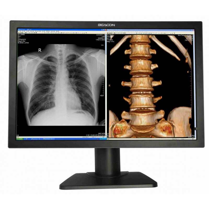 MONITOR MEDICO C44W+